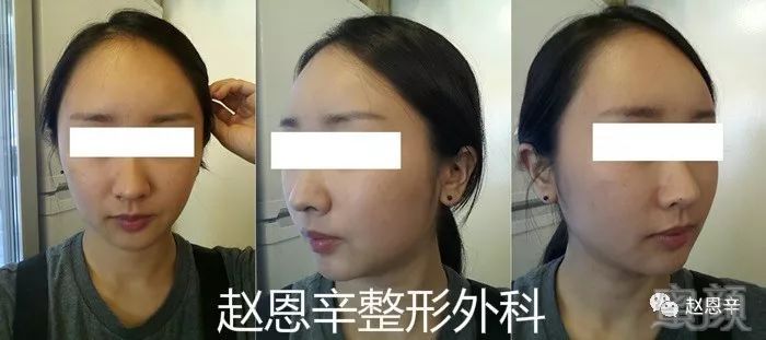 https://img.miyanlife.com/mnt/timg/180306/105U452F-5.jpg