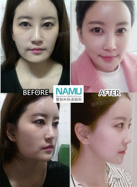 https://img.miyanlife.com/mnt/timg/180306/1143316092-4.jpg