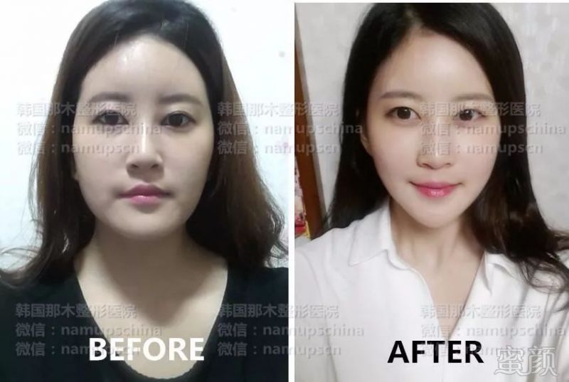 https://img.miyanlife.com/mnt/timg/180306/114331E41-5.jpg