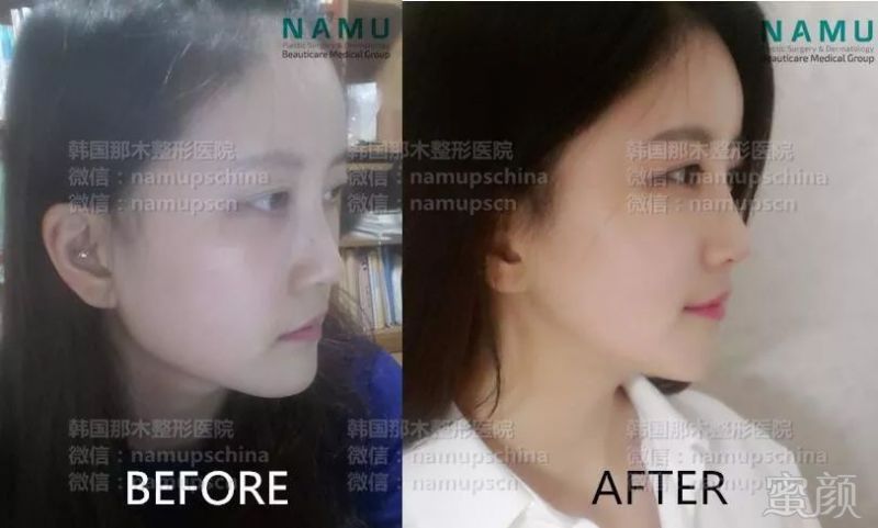 https://img.miyanlife.com/mnt/timg/180306/1143322501-6.jpg
