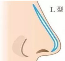 https://img.miyanlife.com/mnt/timg/180306/1151052233-7.jpg