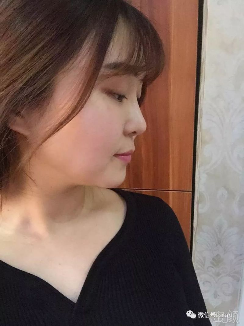 https://img.miyanlife.com/mnt/timg/180306/11521M495-0.jpg