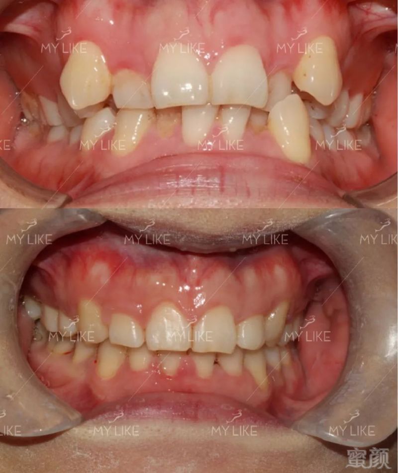 https://img.miyanlife.com/mnt/timg/180306/115Q63A7-2.jpg