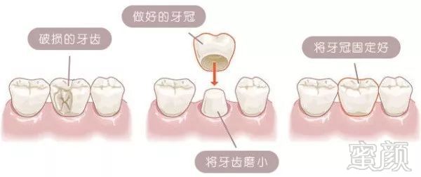 案例图片