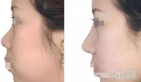 https://img.miyanlife.com/mnt/timg/180306/1202034430-3.jpg