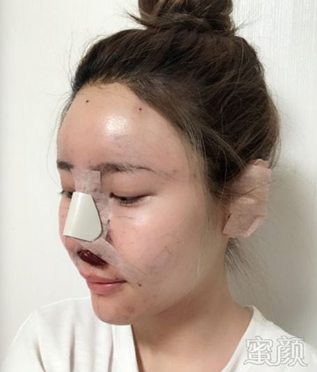 https://img.miyanlife.com/mnt/timg/180306/120313FK-2.jpg
