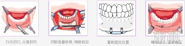 案例图片