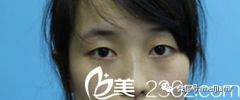 https://img.miyanlife.com/mnt/timg/180307/10494AE5-0.jpg
