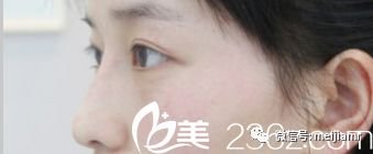 https://img.miyanlife.com/mnt/timg/180307/10494CO8-1.jpg
