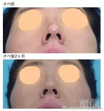 https://img.miyanlife.com/mnt/timg/180307/104A62501-1.jpg