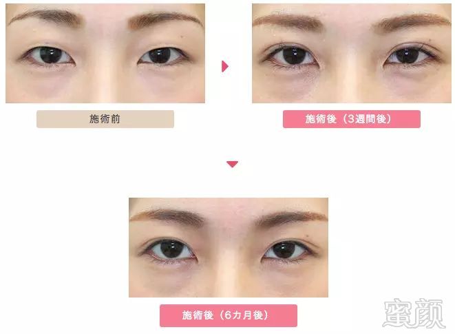 https://img.miyanlife.com/mnt/timg/180307/104A92R0-7.jpg