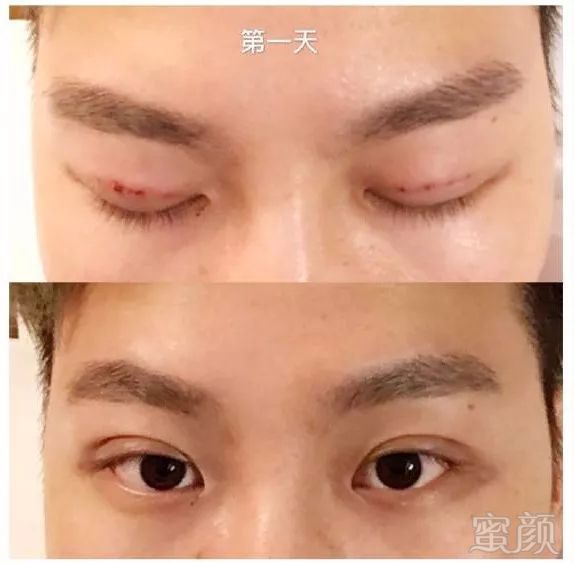 https://img.miyanlife.com/mnt/timg/180307/104A95240-9.jpg