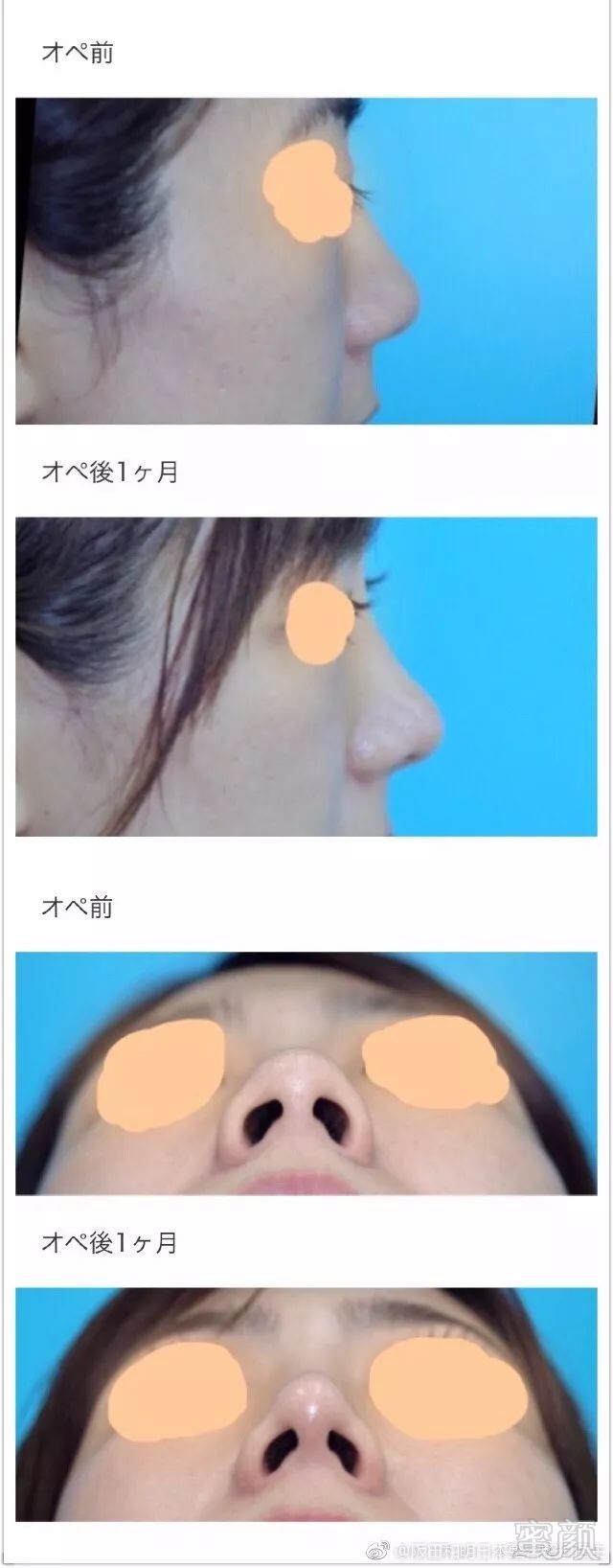 https://img.miyanlife.com/mnt/timg/180307/104AC602-0.jpg