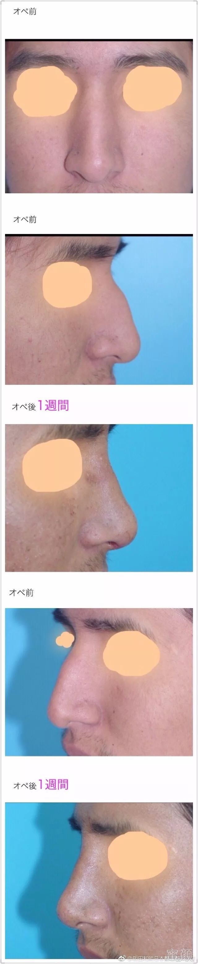 https://img.miyanlife.com/mnt/timg/180307/104AI643-4.jpg