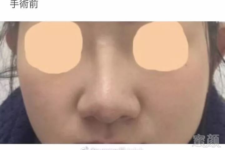 https://img.miyanlife.com/mnt/timg/180307/104AIG2-2.jpg