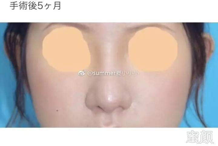 https://img.miyanlife.com/mnt/timg/180307/104AJJ1-3.jpg