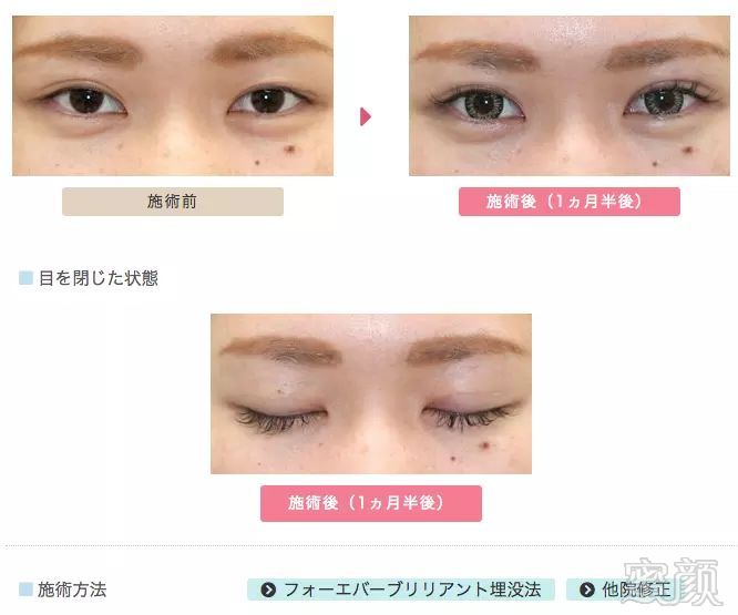 https://img.miyanlife.com/mnt/timg/180307/104ASM8-6.jpg