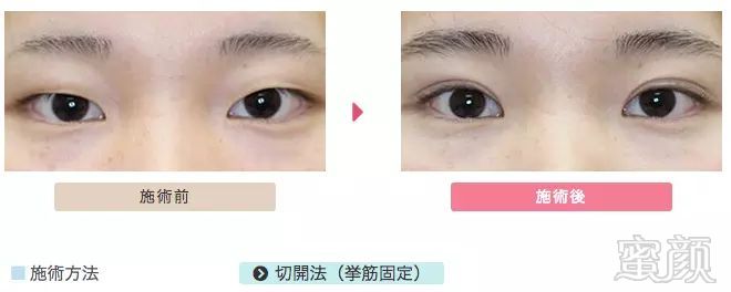 https://img.miyanlife.com/mnt/timg/180307/104ATT4-5.jpg