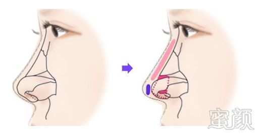 https://img.miyanlife.com/mnt/timg/180307/104K13c7-1.jpg