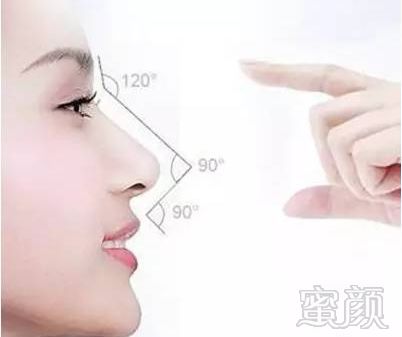 https://img.miyanlife.com/mnt/timg/180307/11132Q331-0.jpg