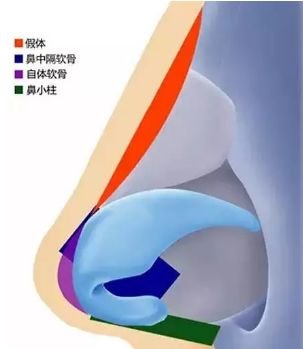 https://img.miyanlife.com/mnt/timg/180307/11134HL8-15.jpg