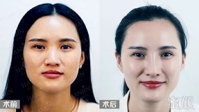 https://img.miyanlife.com/mnt/timg/180307/11134KI6-13.jpg