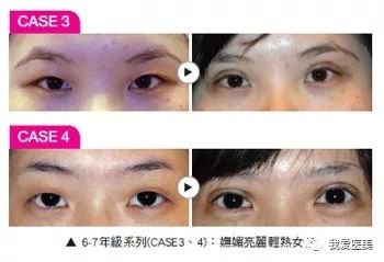 https://img.miyanlife.com/mnt/timg/180307/111912CT-1.jpg