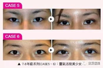 https://img.miyanlife.com/mnt/timg/180307/1119133B6-2.jpg