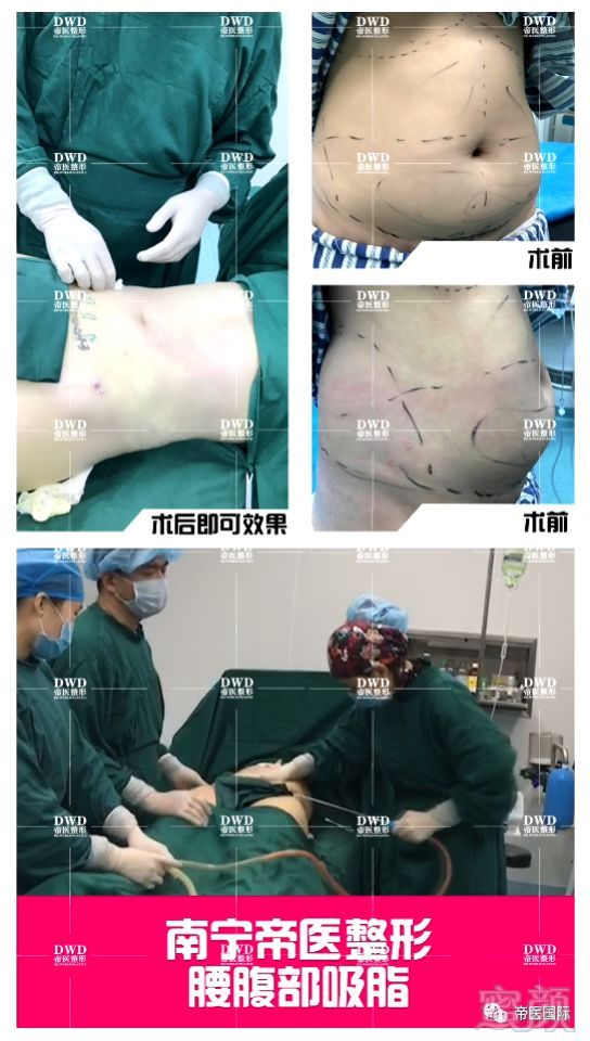 https://img.miyanlife.com/mnt/timg/180307/11192410Y-1.jpg