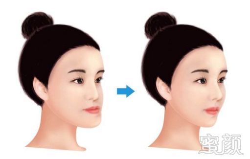 https://img.miyanlife.com/mnt/timg/180307/11192T520-1.jpg