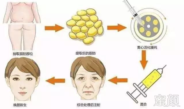 https://img.miyanlife.com/mnt/timg/180307/11235152a-3.jpg