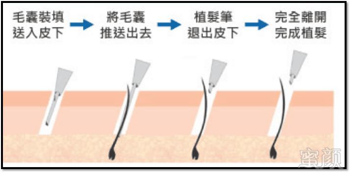 https://img.miyanlife.com/mnt/timg/180307/1156223544-2.jpg