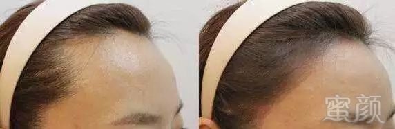 https://img.miyanlife.com/mnt/timg/180307/115624O05-5.jpg