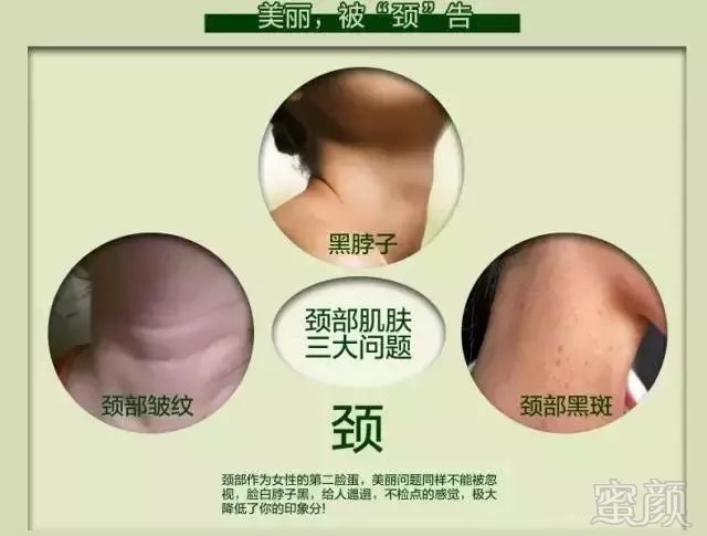 https://img.miyanlife.com/mnt/timg/180307/115J25519-0.jpg