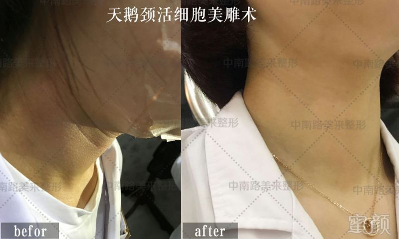https://img.miyanlife.com/mnt/timg/180307/115J54C8-5.jpg