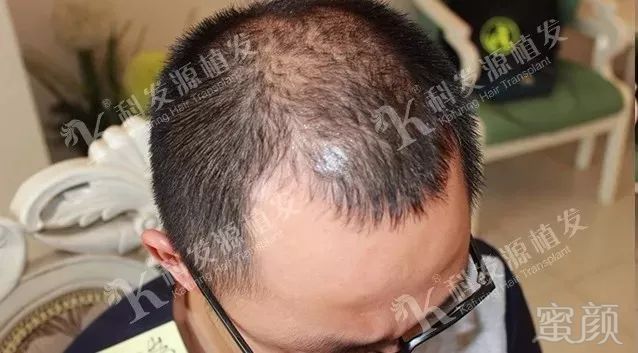 https://img.miyanlife.com/mnt/timg/180307/12113424O-2.jpg