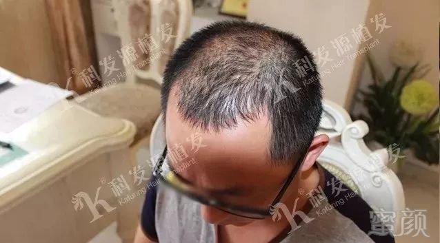 https://img.miyanlife.com/mnt/timg/180307/1211343594-3.jpg