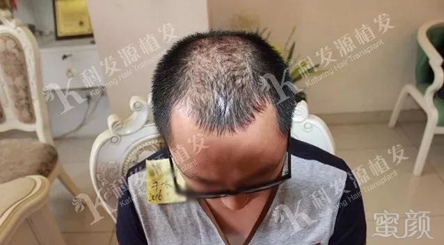 https://img.miyanlife.com/mnt/timg/180307/121134HM-1.jpg