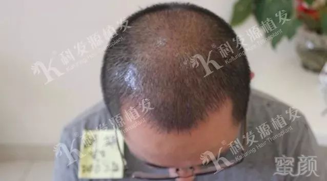 https://img.miyanlife.com/mnt/timg/180307/1211353518-7.jpg