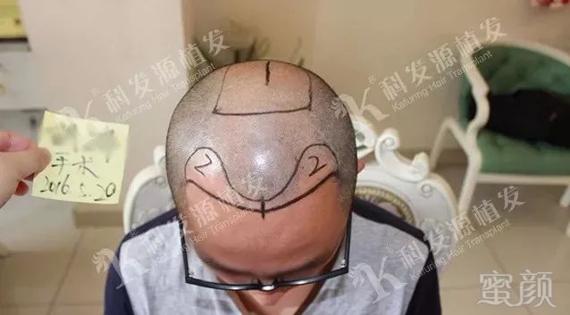 https://img.miyanlife.com/mnt/timg/180307/1211356020-4.jpg