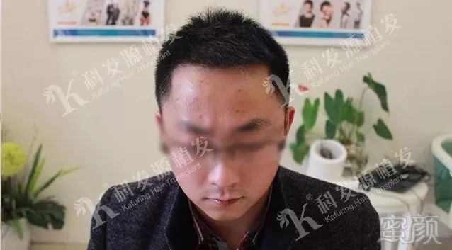 https://img.miyanlife.com/mnt/timg/180307/12113B613-10.jpg