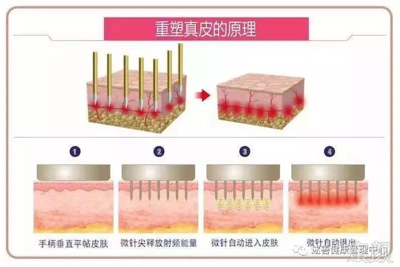 https://img.miyanlife.com/mnt/timg/180307/1213241X9-2.jpg