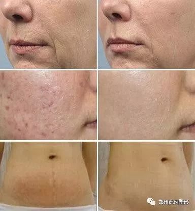 https://img.miyanlife.com/mnt/timg/180307/121325C38-4.jpg