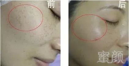 https://img.miyanlife.com/mnt/timg/180307/12145Ua4-2.jpg