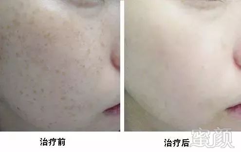 https://img.miyanlife.com/mnt/timg/180307/12145W0a-3.jpg