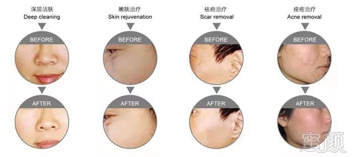 https://img.miyanlife.com/mnt/timg/180307/12145W421-1.jpg