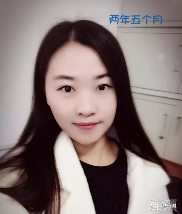 https://img.miyanlife.com/mnt/timg/180307/1224261A4-2.jpg