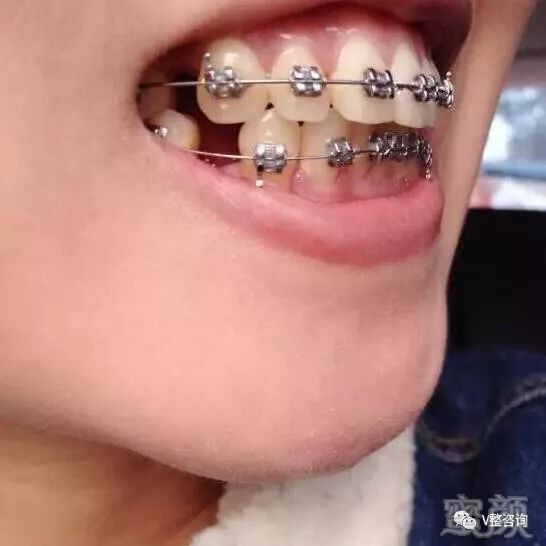 https://img.miyanlife.com/mnt/timg/180307/12242644b-1.jpg
