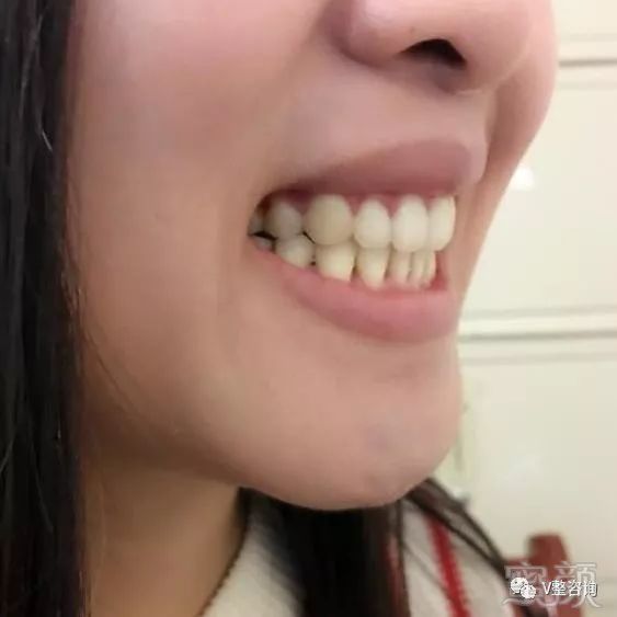 https://img.miyanlife.com/mnt/timg/180307/12242L4Q-3.jpg