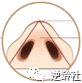 https://img.miyanlife.com/mnt/timg/180307/1233352M0-5.jpg